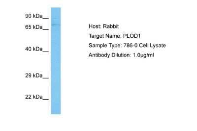 Western Blot: PLOD1 Antibody [NBP2-85500] - Host: Rabbit. Target Name: PLOD1. Sample Tissue: Human 786-0 Whole Cell lysates. Antibody Dilution: 1ug/ml