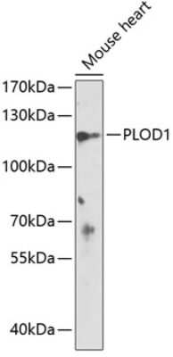 Western Blot: PLOD1 Antibody [NBP2-94781] - Analysis of extracts of mouse heart, using PLOD1 .Exposure time: 60s.