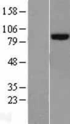 Western Blot: PLOD2 Overexpression Lysate (Adult Normal) [NBL1-14522] Left-Empty vector transfected control cell lysate (HEK293 cell lysate); Right -Over-expression Lysate for PLOD2.