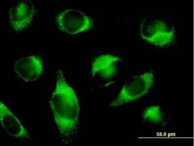 Immunocytochemistry/Immunofluorescence: PLOD3 Antibody [H00008985-B01P] - Analysis of purified antibody to PLOD3 on HeLa cell. (antibody concentration 10 ug/ml)