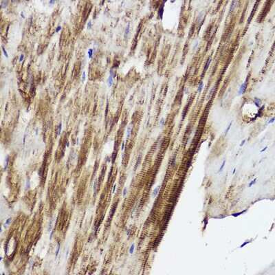 Immunohistochemistry-Paraffin: PLOD3 Antibody [NBP2-94177] - Immunohistochemistry of paraffin-embedded mouse heart using PLOD3 Rabbit pAb (NBP2-94177) at dilution of 1:50 (40x lens). Perform high pressure antigen retrieval with 10 mM citrate buffer pH 6.0 before commencing with IHC staining protocol.