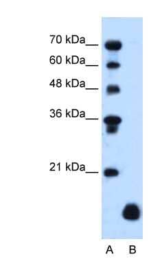 Western Blot: PLP2 Antibody [NBP1-62539] - HepG2 cell lysate, concentration 1.25ug/ml.