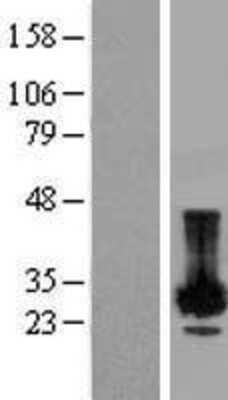 Western Blot: PLP2 Overexpression Lysate (Adult Normal) [NBP2-08081] Left-Empty vector transfected control cell lysate (HEK293 cell lysate); Right -Over-expression Lysate for PLP2.