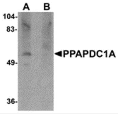 Western Blot: PLPP4/PPAPDC1A Antibody [NBP2-81931] - Analysis of PLPP4/PPAPDC1A in human brain tissue lysate with PLPP4/PPAPDC1A antibody at 1 ug/ml in (A) the absence and (B) the presence of blocking peptide.