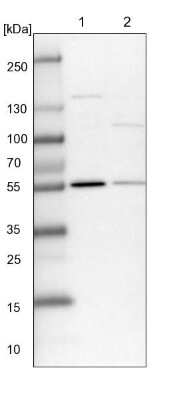 Western Blot: PLRG1 Antibody [NBP1-87225] - Lane 1: NIH-3T3 cell lysate (Mouse embryonic fibroblast cells). Lane 2: NBT-II cell lysate (Rat Wistar bladder tumor cells).