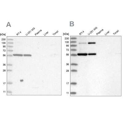 <b>Independent Antibodies Validation. </b>Western Blot: PLRG1 Antibody [NBP1-87225] - Analysis using Anti-PLRG1 antibody NBP1-87225 (A) shows similar pattern to independent antibody NBP2-48650 (B).