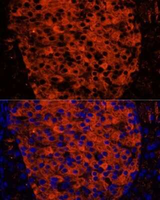 Immunohistochemistry: PLRP1 Antibody [NBP2-94066] - Analysis of mouse pancreas using PLRP1 at dilution of 1:100. Blue: DAPI for nuclear staining.