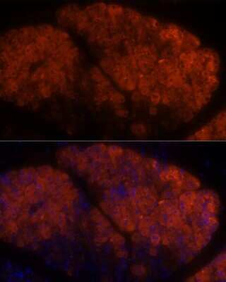 Immunohistochemistry: PLRP1 Antibody [NBP2-94066] - Analysis of rat pancreas using PLRP1 at dilution of 1:100. Blue: DAPI for nuclear staining.