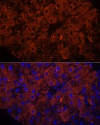 Immunohistochemistry: PLRP1 Antibody [NBP2-94066] - Analysis of rat pancreas using PLRP1 at dilution of 1:100. Blue: DAPI for nuclear staining.