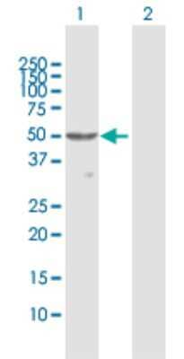 Western Blot: PLRP1 Antibody [H00005407-D01P] - Analysis of PNLIPRP1 expression in transfected 293T cell line by PNLIPRP1 polyclonal antibody.Lane 1: PNLIPRP1 transfected lysate(51.80 KDa).Lane 2: Non-transfected lysate.