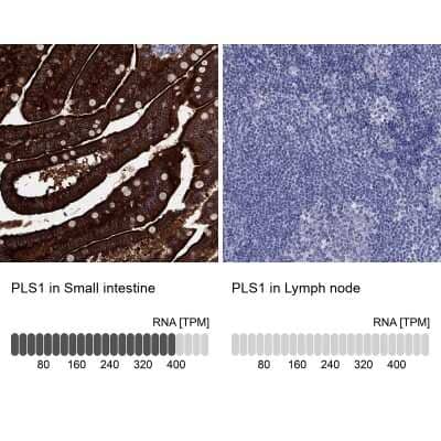 Immunocytochemistry/Immunofluorescence: PLS1 Antibody [NBP3-17087] - Analysis in human small intestine and lymph node tissues using Anti-PLS1 antibody. Corresponding PLS1 RNA-seq data are presented for the same tissues.