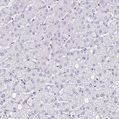 Immunohistochemistry-Paraffin: PLS1 Antibody [NBP2-30592] - Staining of human liver shows low expression as expected.