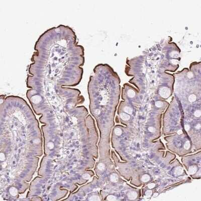 Immunohistochemistry-Paraffin: PLS1 Antibody [NBP2-30592] - Staining of human small intestine shows high expression.