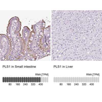 <b>Orthogonal Strategies Validation. </b>Immunohistochemistry-Paraffin: PLS1 Antibody [NBP2-30592] - Staining in human small intestine and liver tissues using anti-PLS1 antibody. Corresponding PLS1 RNA-seq data are presented for the same tissues.