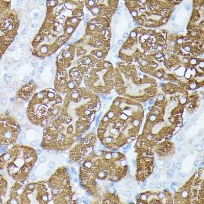 Immunohistochemistry-Paraffin: PLS1 Antibody [NBP2-94642] - Paraffin-embedded mouse kidney using PLS1 .