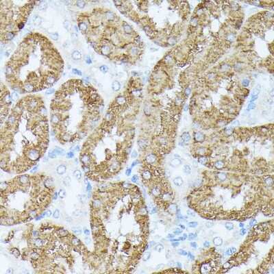 Immunohistochemistry-Paraffin: PLS1 Antibody [NBP2-94642] - Paraffin-embedded rat kidney using PLS1 .