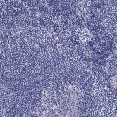 Immunohistochemistry-Paraffin: PLS1 Antibody [NBP3-17087] - Staining of human lymph node shows low expression as expected.