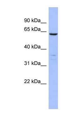 Western Blot: PLS1 Antibody [NBP1-56555] - Human Lung lysate, concentration 0.2-1 ug/ml.