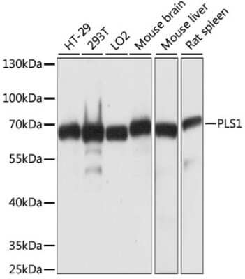 Western Blot: PLS1 Antibody [NBP2-94642] - Analysis of extracts of various cell lines, using PLS1 at 1:1000 dilution. Secondary antibody: HRP Goat Anti-Rabbit IgG (H+L) at 1:10000 dilution. Lysates/proteins: 25ug per lane. Blocking buffer: 3% nonfat dry milk in TBST. Detection: ECL Basic Kit . Exposure time: 3s.