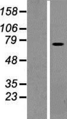 Western Blot: PLS1 Overexpression Lysate (Adult Normal) [NBP2-09739] Left-Empty vector transfected control cell lysate (HEK293 cell lysate); Right -Over-expression Lysate for PLS1.