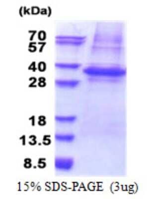 SDS-PAGE Recombinant Human PLSCR3 His Protein
