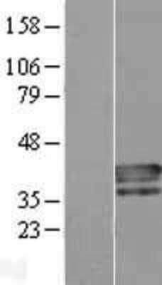 Western Blot: PLSCR4 Overexpression Lysate (Adult Normal) [NBP2-09475] Left-Empty vector transfected control cell lysate (HEK293 cell lysate); Right -Over-expression Lysate for PLSCR4.
