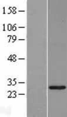 Western Blot: PLUNC Overexpression Lysate (Adult Normal) [NBL1-14530] Left-Empty vector transfected control cell lysate (HEK293 cell lysate); Right -Over-expression Lysate for PLUNC.