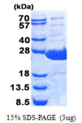 SDS-Page: Recombinant Human PLUNC Protein [NBP2-22716]