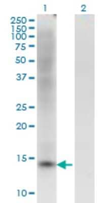 Western Blot: PLZF Antibody (1F10) [H00007704-M02] - Analysis of ZBTB16 expression in transfected 293T cell line by ZBTB16 monoclonal antibody (M02), clone 1F10.Lane 1: ZBTB16 transfected lysate (Predicted MW: 11.11 KDa).Lane 2: Non-transfected lysate.