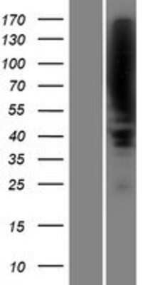 Western Blot: PLZF Overexpression Lysate (Adult Normal) [NBP2-10434] Left-Empty vector transfected control cell lysate (HEK293 cell lysate); Right -Over-expression Lysate for PLZF.