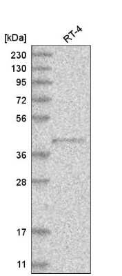 Western Blot: PM20D2 Antibody [NBP2-56435] - Analysis in human cell line RT-4.