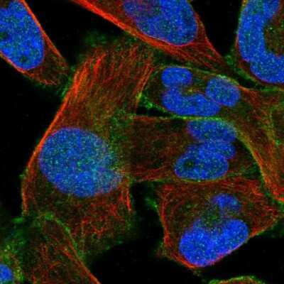 Immunocytochemistry/Immunofluorescence: PMCA1 Antibody [NBP1-87261] - Immunofluorescent staining of human cell line RH-30 shows localization to nucleus & plasma membrane.