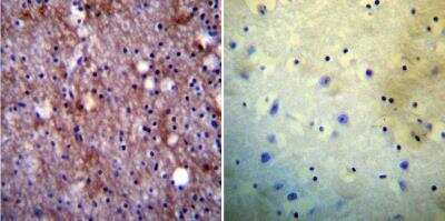 Immunohistochemistry-Paraffin: PMCA1 Antibody [NB120-3528] - Immunohistochemistry was performed on normal biopsies of deparaffinized Human brain tissue. To expose target proteins, heat induced antigen retrieval was performed using 10mM sodium citrate (pH6.0)  buffer, microwaved for 8-15 minutes. Following antigen retrieval tissues were blocked in 3% BSA-PBS for 30 minutes at room temperature. Tissues were then probed at a dilution of 1:20 with a rabbit polyclonal antibody recognizing PMCA1 ATPase or without primary antibody (negative control) overnight at 4C in a humidified chamber. Tissues were washed extensively with PBST and endogenous peroxidase activity was quenched with a peroxidase suppressor.  Tissues were counterstained with hematoxylin and prepped for mounting.