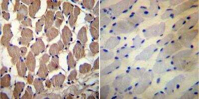 Immunohistochemistry-Paraffin: PMCA1 Antibody [NB120-3528] - Immunohistochemistry was performed on normal biopsies of deparaffinized Human skeletal muscle tissue. To expose target proteins, heat induced antigen retrieval was performed using 10mM sodium citrate (pH6.0)  buffer, microwaved for 8-15 minutes. Following antigen retrieval tissues were blocked in 3% BSA-PBS for 30 minutes at room temperature. Tissues were then probed at a dilution of 1:20 with a rabbit polyclonal antibody recognizing PMCA1 ATPase or without primary antibody (negative control) overnight at 4C in a humidified chamber. Tissues were washed extensively with PBST and endogenous peroxidase activity was quenched with a peroxidase suppressor.  Tissues were counterstained with hematoxylin and prepped for mounting.