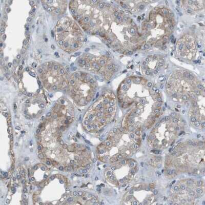 Immunohistochemistry-Paraffin: PMCA1 Antibody [NBP1-87260] - Staining of human kidney shows low expression as expected.