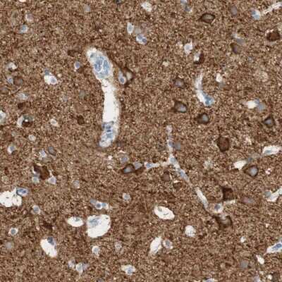 Immunohistochemistry-Paraffin: PMCA1 Antibody [NBP1-87261] - Staining of human cerebral cortex shows high expression.