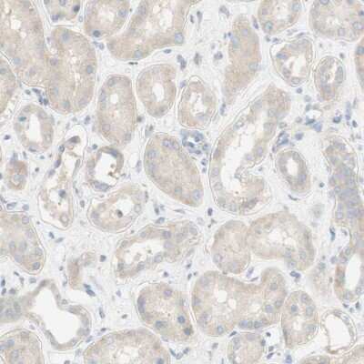 Immunohistochemistry-Paraffin: PMCA1 Antibody [NBP1-87261] - Staining of human kidney shows low expression as expected.