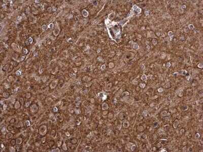 Immunohistochemistry-Paraffin: PMCA1 Antibody [NBP3-12964] - PMCA1 antibody detects PMCA1 protein at cell membrane and cytoplasm in mouse brain by immunohistochemical analysis. Sample: Paraffin-embedded mouse brain. PMCA1 antibody (NBP3-12964) diluted at 1:500. Antigen Retrieval: Citrate buffer, pH 6.0, 15 min