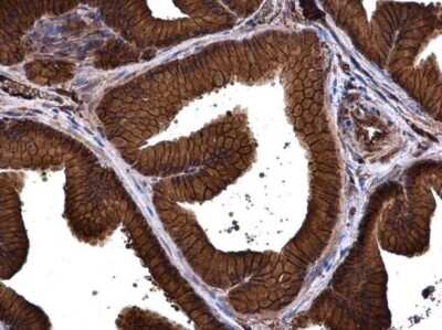 Immunohistochemistry-Paraffin: PMCA1 Antibody [NBP3-12964] - PMCA1 antibody detects PMCA1 protein at cell membrane and cytoplasm in rat prostate by immunohistochemical analysis. Sample: Paraffin-embedded rat prostate. PMCA1 antibody (NBP3-12964) diluted at 1:500. Antigen Retrieval: Citrate buffer, pH 6.0, 15 min