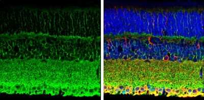 Immunohistochemistry-Paraffin: PMCA1 Antibody [NBP3-12964] - PMCA1 antibody detects PMCA1 protein expression by immunohistochemical analysis. Sample:Paraffin-Embedded adult mouse retina. Green: PMCA1 protein stained by PMCA1 antibody (NBP3-12964) diluted at 1:250. Red: beta Tubulin 3/ TUJ1, stained by beta Tubulin 3/ TUJ1 antibody [GT11710] (NBP2-43559) diluted at 1:500. Blue: Fluoroshield with DAPI.