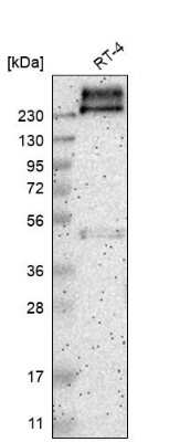 <b>Orthogonal Strategies Validation. </b>Western Blot: PMCA1 Antibody [NBP1-87260] - Analysis in human cell line RT-4.