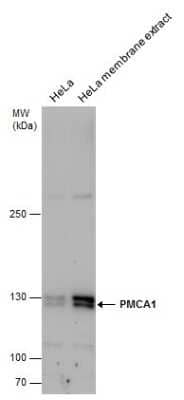 Western Blot: PMCA1 Antibody [NBP3-12964] - PMCA1 antibody detects PMCA1 protein by western blot analysis. HeLa whole cell extracts and membrane extracts(the extracts were unboiled )(30 ug) were separated by 5% SDS-PAGE, and the membrane was blotted with PMCA1 antibody (NBP3-12964) at a dilution of 1:1000.