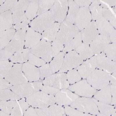 Immunohistochemistry-Paraffin: PMCA3 Antibody [NBP1-87259] - Staining of human skeletal muscle shows no positivity in myocytes as expected.