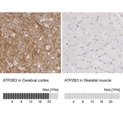 Immunohistochemistry-Paraffin: PMCA3 Antibody [NBP1-87259] - Analysis in human cerebral cortex and skeletal muscle tissues using NBP1-87259 antibody. Corresponding PMCA3 RNA-seq data are presented for the same tissues.