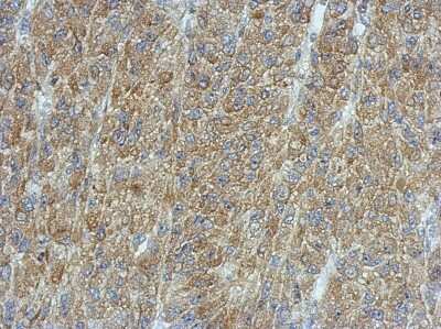 Immunohistochemistry-Paraffin: PMCA3 Antibody [NBP2-19871] -  U87 xenograft, using ATP2B3  antibody at 1:500 dilution. Antigen Retrieval: Trilogy™ (EDTA based, pH 8.0) buffer, 15min. 