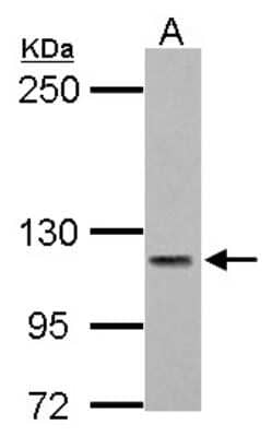 Western Blot: PMCA3 Antibody [NBP2-19871] - Sample (30 ug of whole cell lysate) A: U87-MG 5% SDS PAGE gel, diluted at 1:1000.