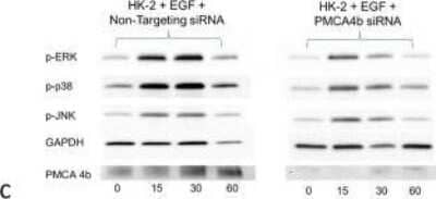 Western Blot: PMCA4 Antibody (2G8) [H00000493-M07] - PMCA4b inhibition abrogates renalase peptide mediated MAPK signaling and cytoprotection. Lack of effect of siRNA mediated inhibition of PMCA4b expression on epidermal growth factor (EGF)- mediated MAPK signaling; left panel: EGF (100 ng/ml) mediated ERK, p38 activation and c-Jun N-Terminal Kinase (JNK) in HK-2 cells transfected with non-targeting siRNA, p = phosphorylated, representative blot; right panel: EGF-mediated ERK, p38 and JNK activation in HK-2 cells unaffected by transfection with PMCA4b siRNA and downregulation of PMCA4b expression; representative blot (n = 3). Image collected and cropped by CiteAb from the following publication (//dx.plos.org/10.1371/journal.pone.0122932), licensed under a CC-BY license.