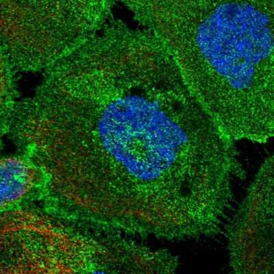 Immunocytochemistry/Immunofluorescence: PMCA4 Antibody [NBP2-31984] - Immunofluorescent staining of human cell line A-431 shows localization to plasma membrane.