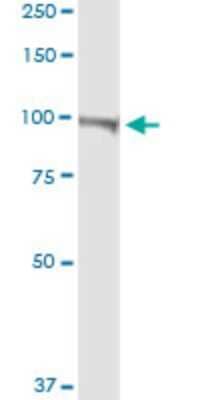 Western Blot: PMCA4 Antibody [H00000493-D01P] - Analysis of ATP2B4 expression in human colon.