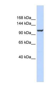 Western Blot: PMCA4 Antibody [NBP1-59481] - 721_B cell lysate, concentration 0.2-1 ug/ml.